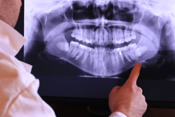 Best Urgent Care for Lost Fillings or Crowns in Kenilworth, NJ