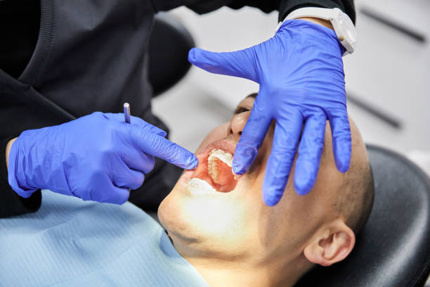 Best Emergency Dental Care for Broken or Chipped Teeth in Kenilworth, NJ